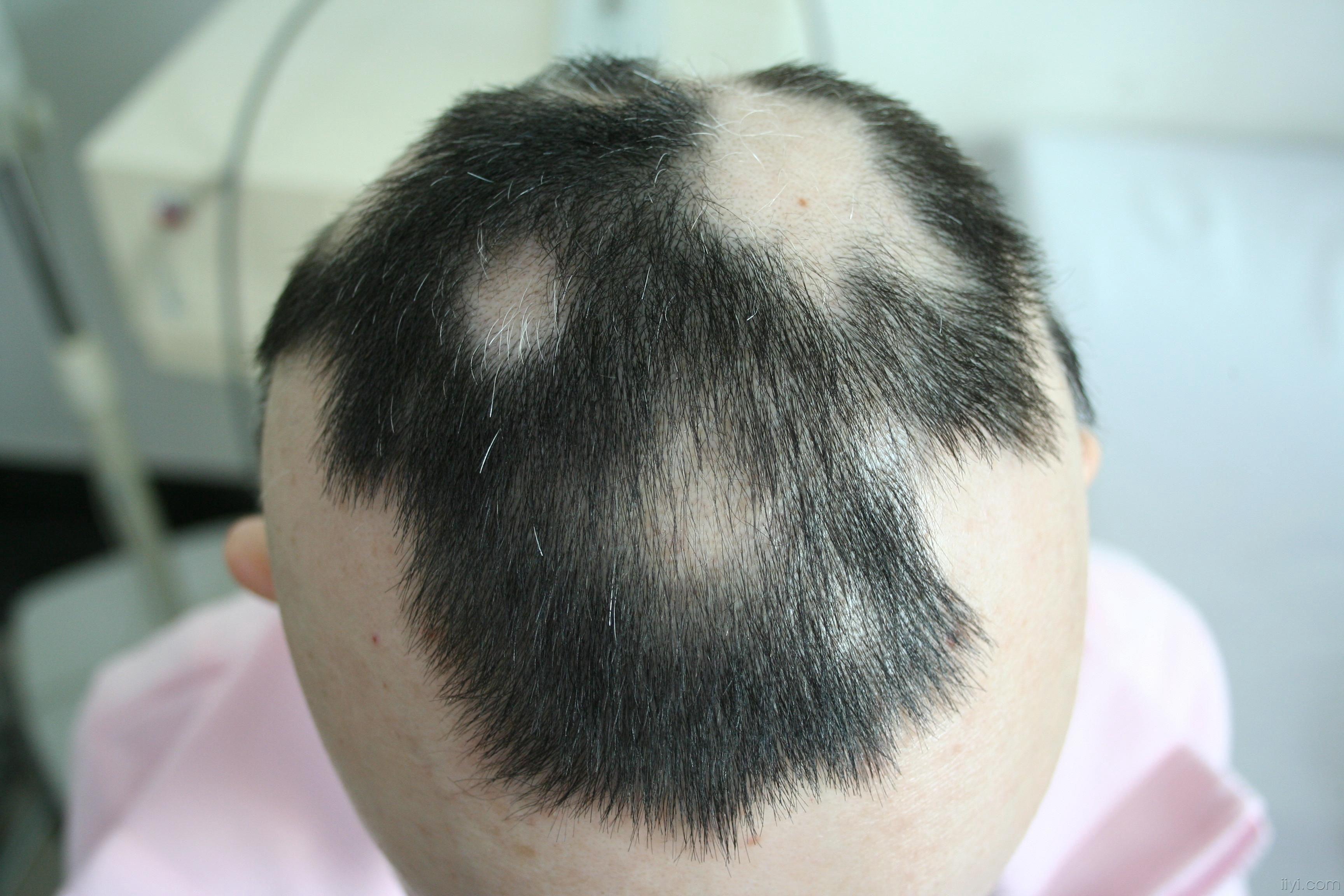 皮肤科摄影展的照片,愿意用做图谱的请把原图发到图谱征集帖!