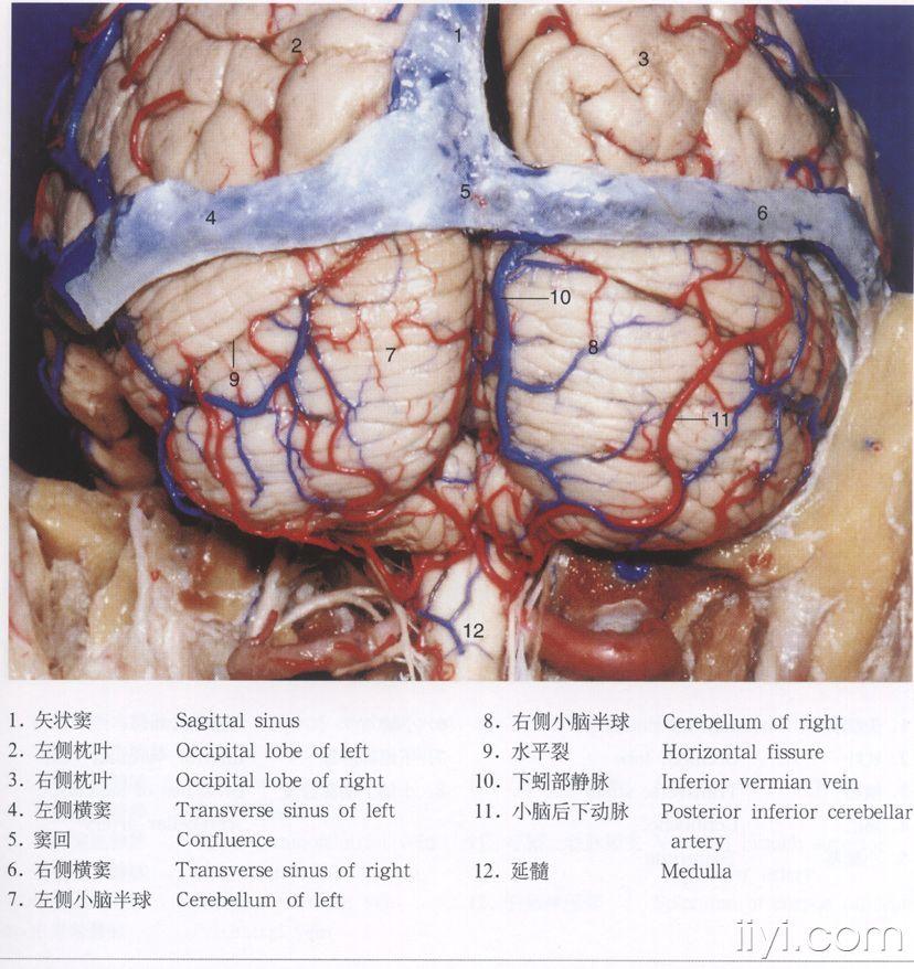 脑解剖图片