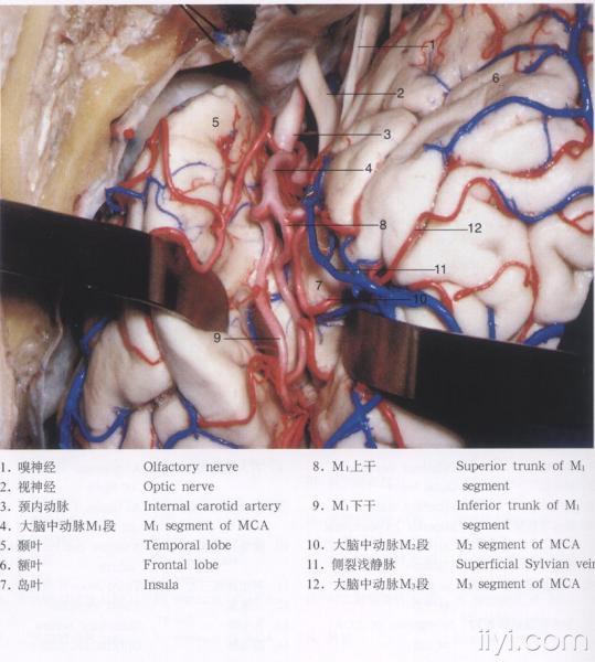 脑解剖图片