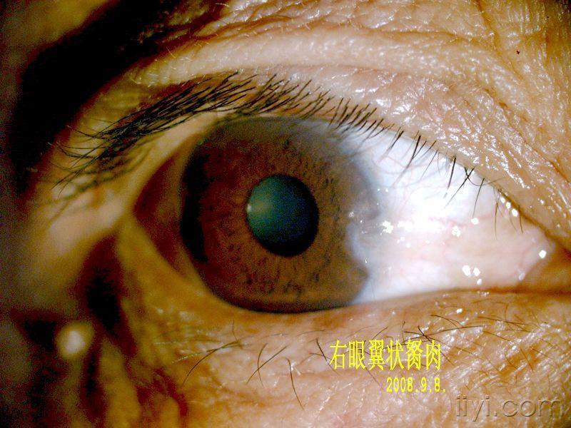 原创【眼前节彩色照片】.新的照片将陆续上传