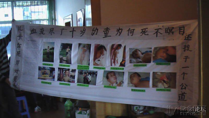 幼童大脑主血管不翼而飞,鲜血流干惨死医院[图集]