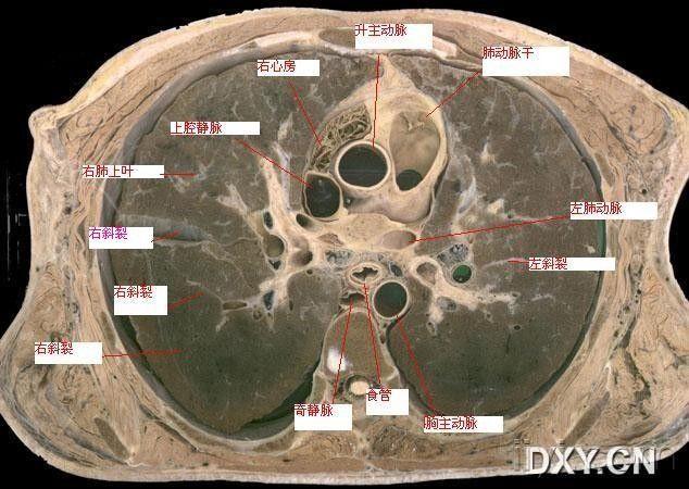 肺部分段ct断面解剖图图片