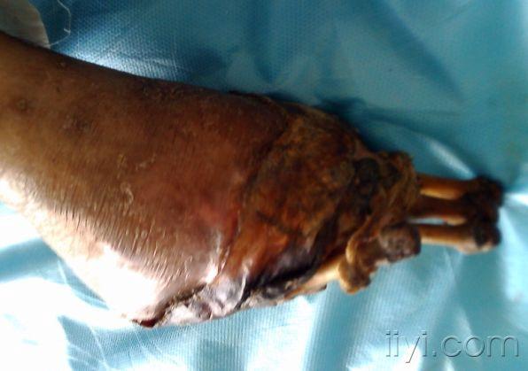 你见过这样的脚吗