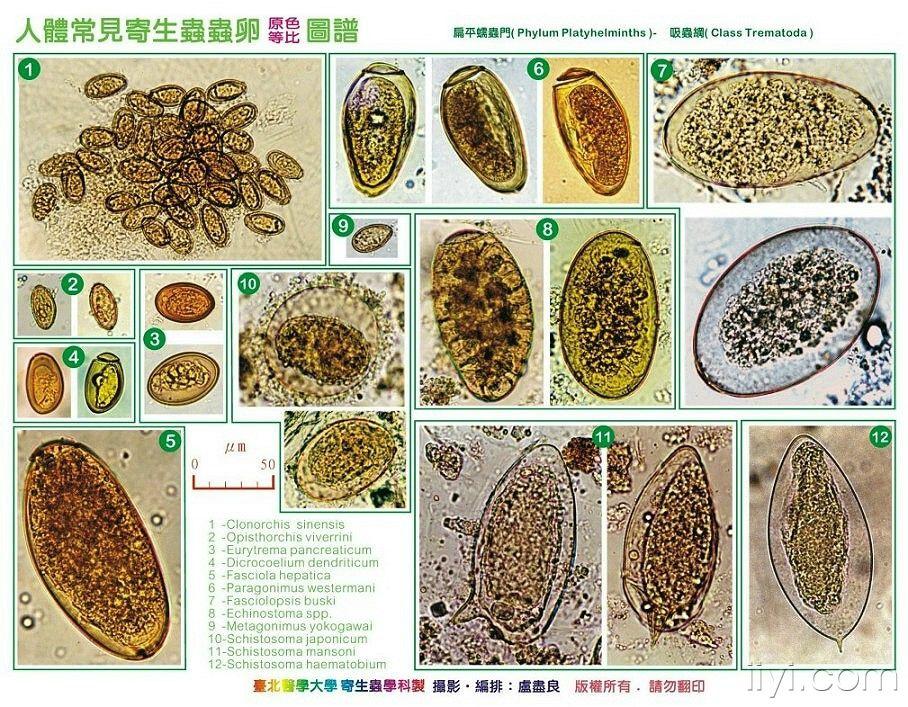 台北医学大学精美寄生虫虫卵图(超清晰)