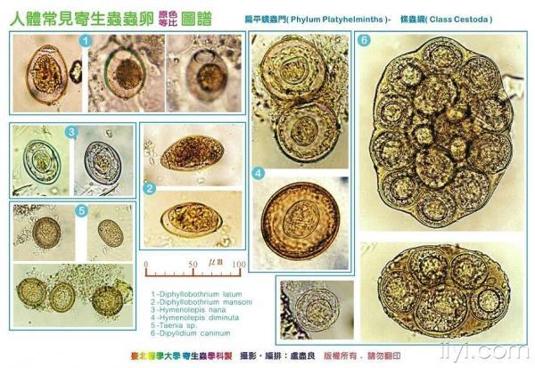 粪类圆线虫虫卵图片