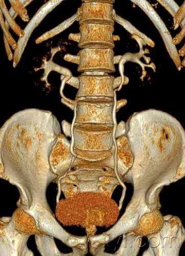 体检发现右肾占位7天
