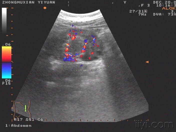 超聲醫學討論版 - 愛愛醫醫學論壇 - 愛愛醫醫學網