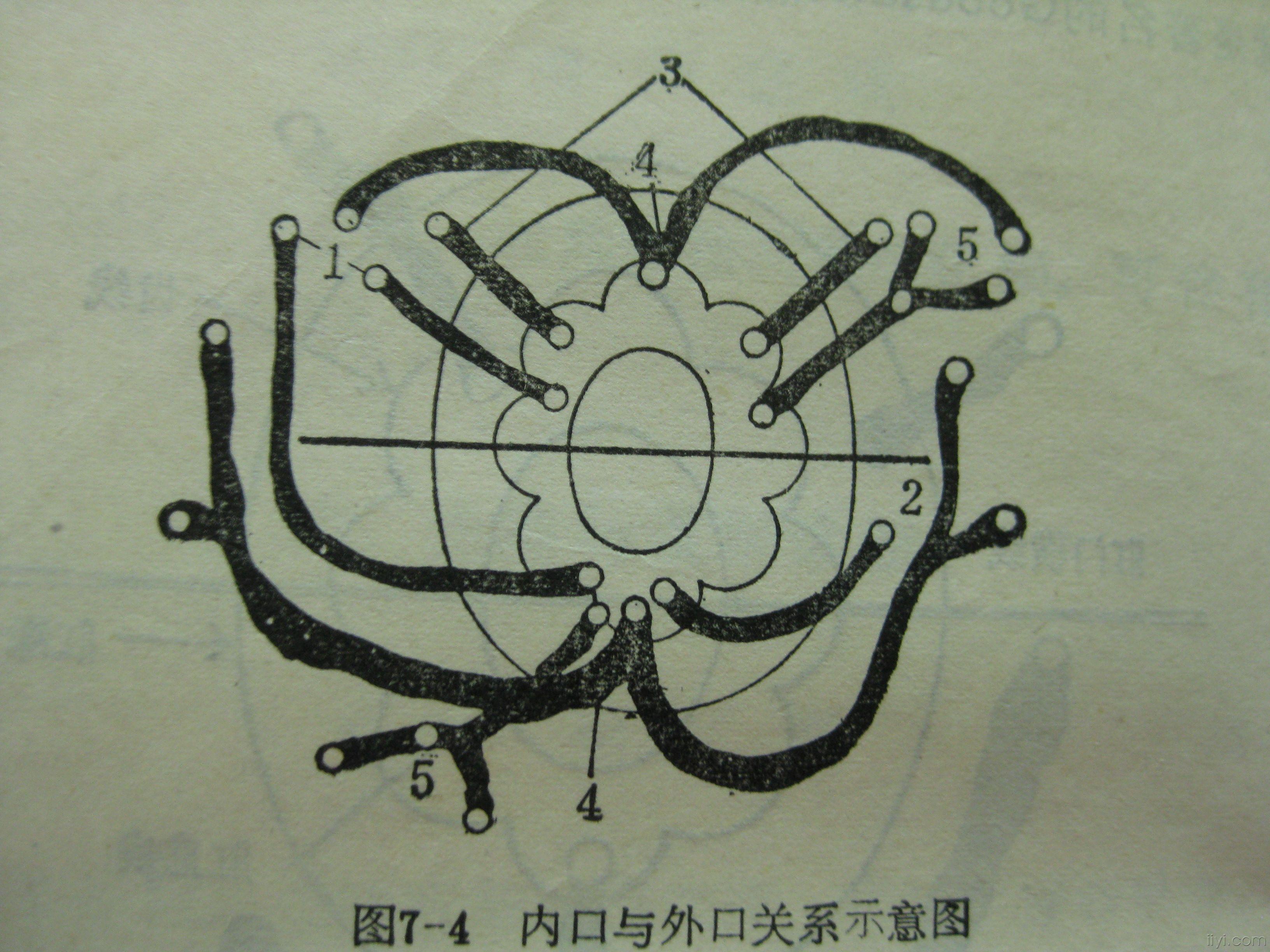 马蹄形肛瘘图片图解图片