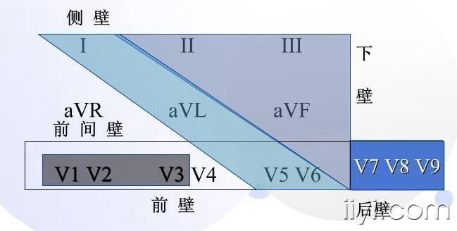 心梗定位