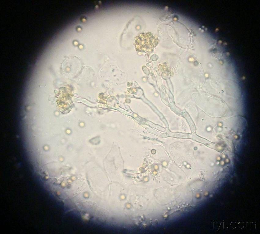 曲霉40倍显微镜图图片