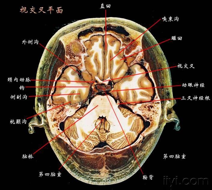 大脑断层解剖图谱2
