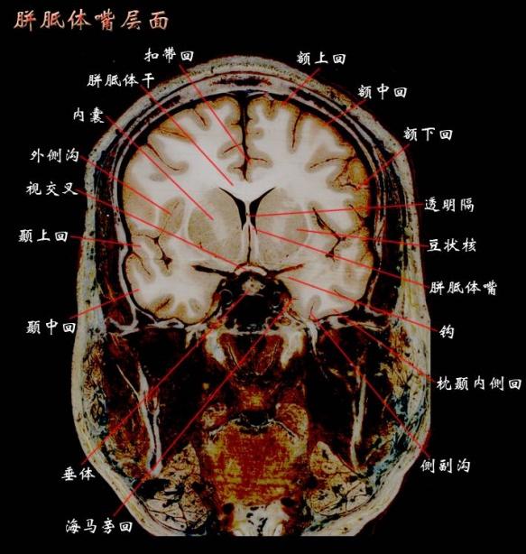 大腦斷層解剖圖譜2