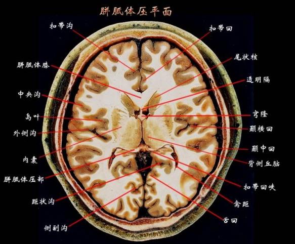 颅脑分叶断层解剖图图片