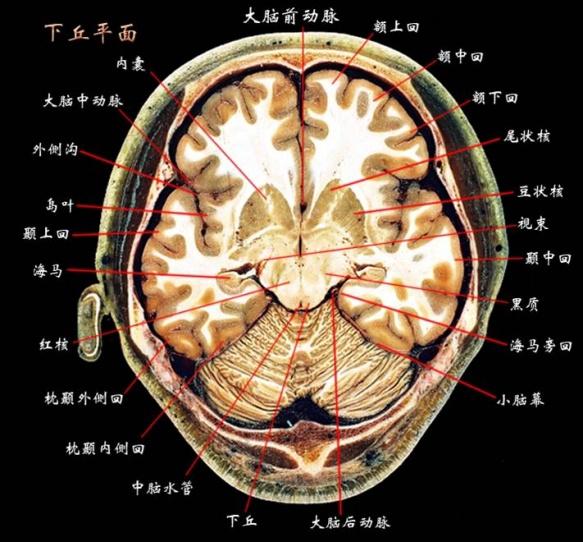 背侧丘脑断层解剖图图片