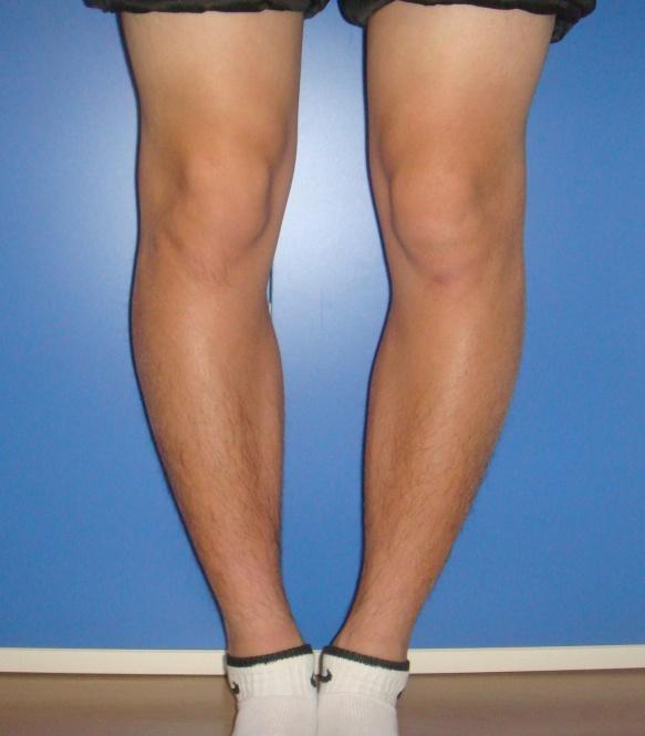 男生标准腿型图片