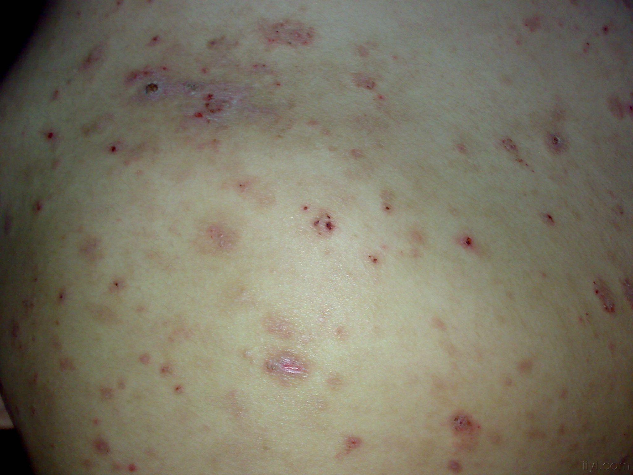 请专家会诊(有图片)!