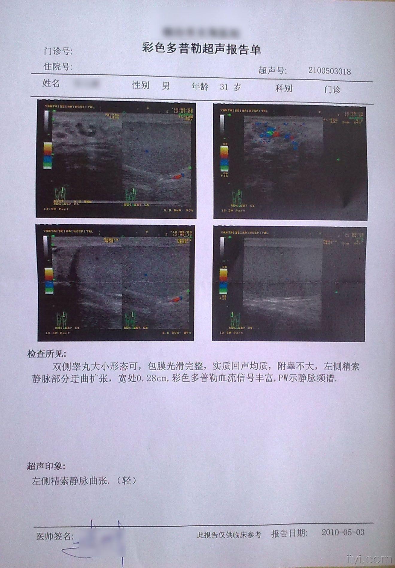 正常睾丸彩超图图片