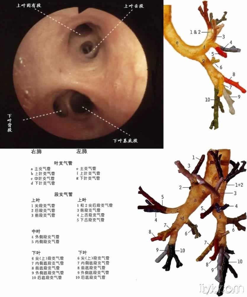 纤维支气管镜简易图片!简单易懂!