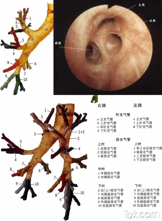 支气管镜解剖图谱图片