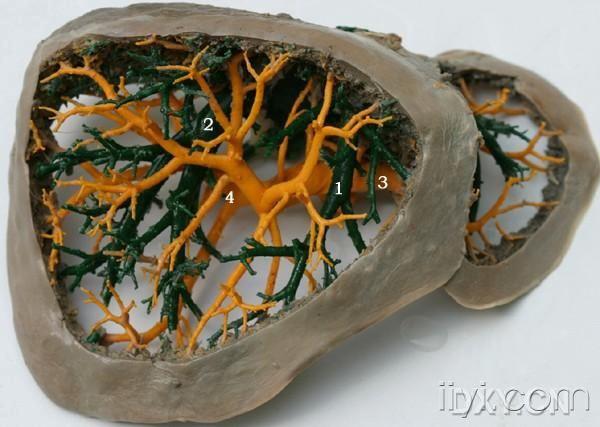 肝脏铸型图 转来的供大家学习下