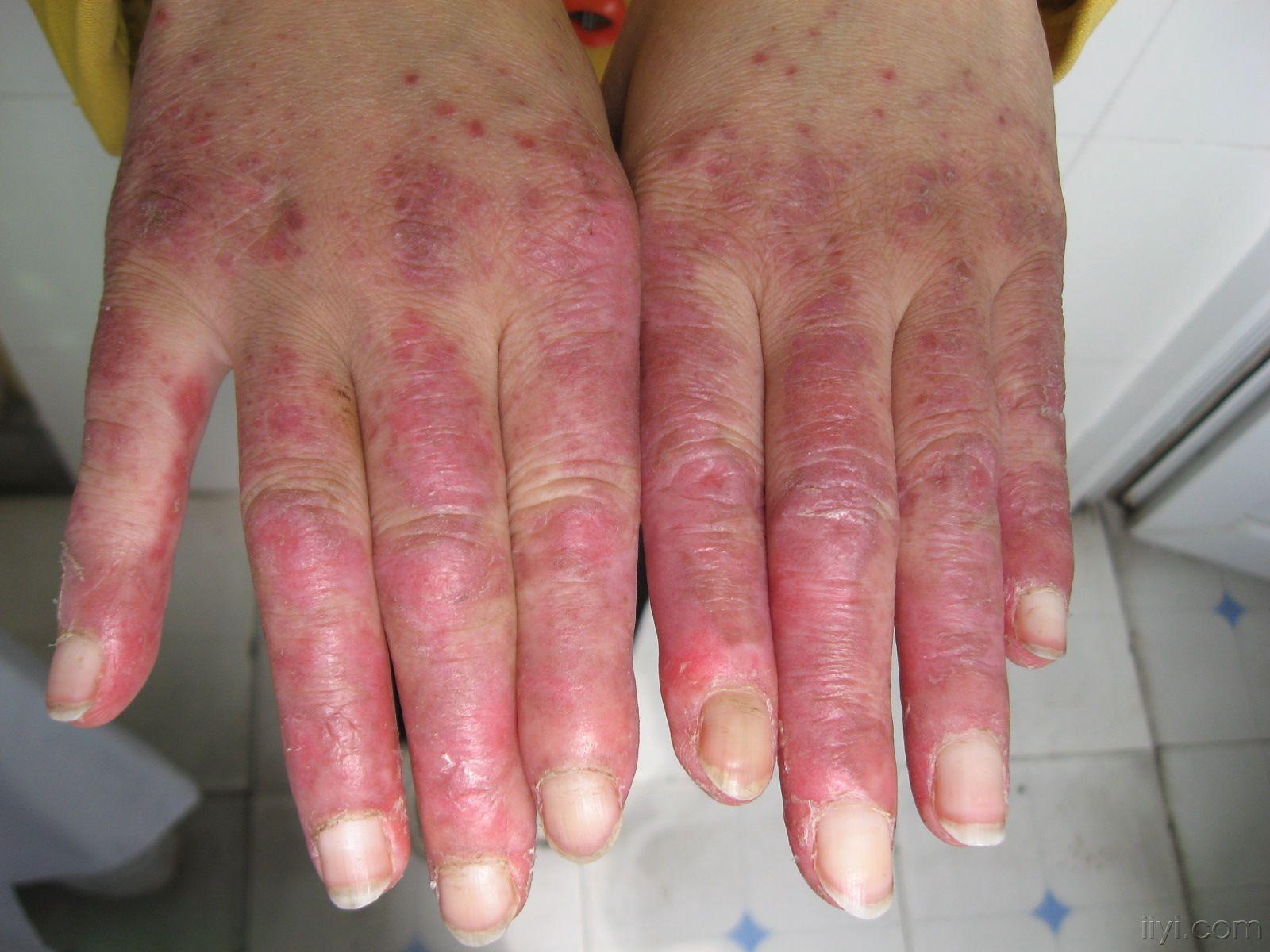 请为爱爱医图谱贡献了图片的朋友及时跟帖,发地址,七