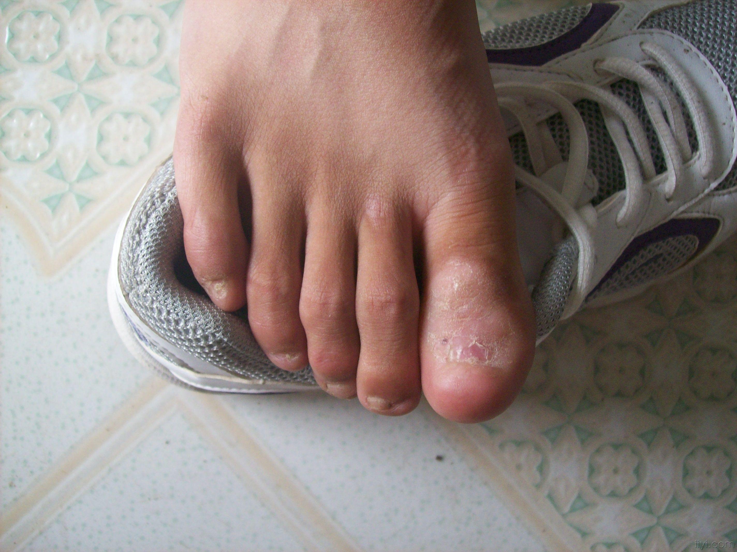 甲病,和王不留行的一样