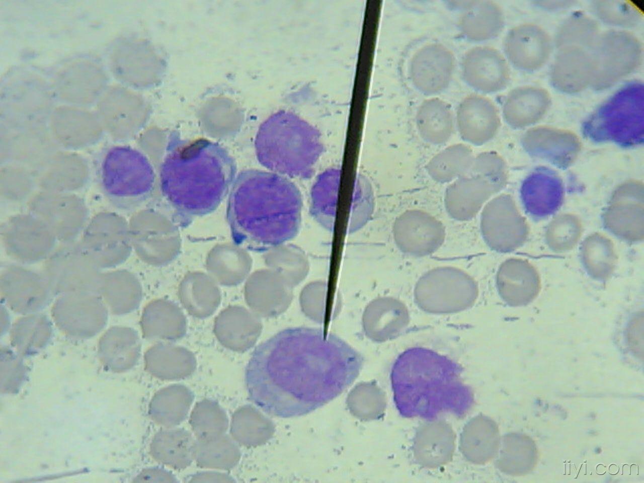 好的骨髓图片