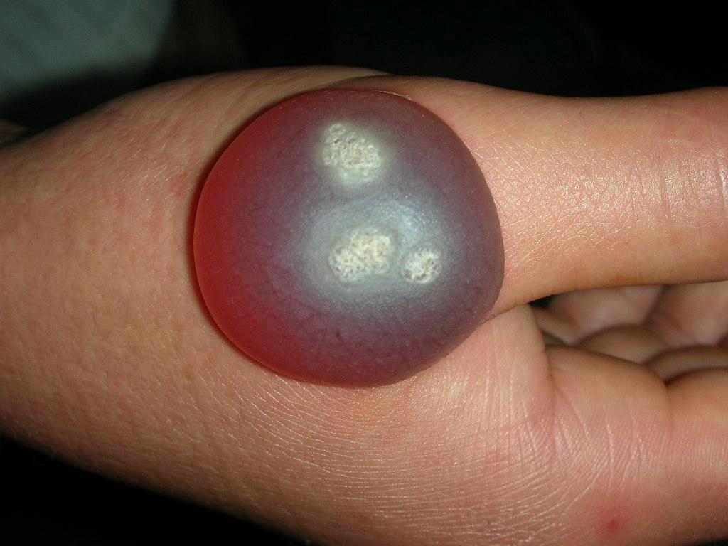 楼主9982010-10-21 12:33:24右手血疱.