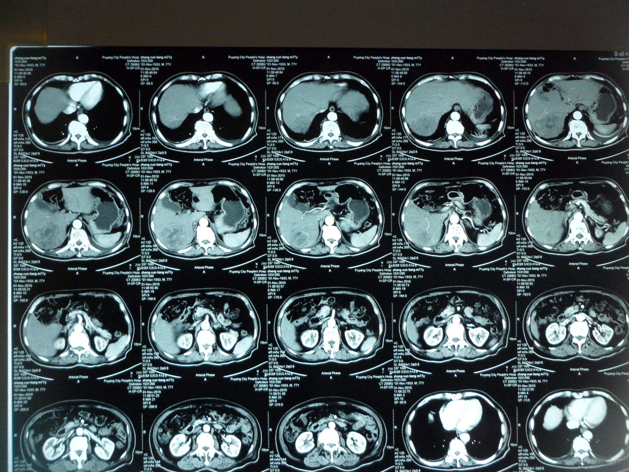 大家一起来看看这个ct,答对有奖励哦