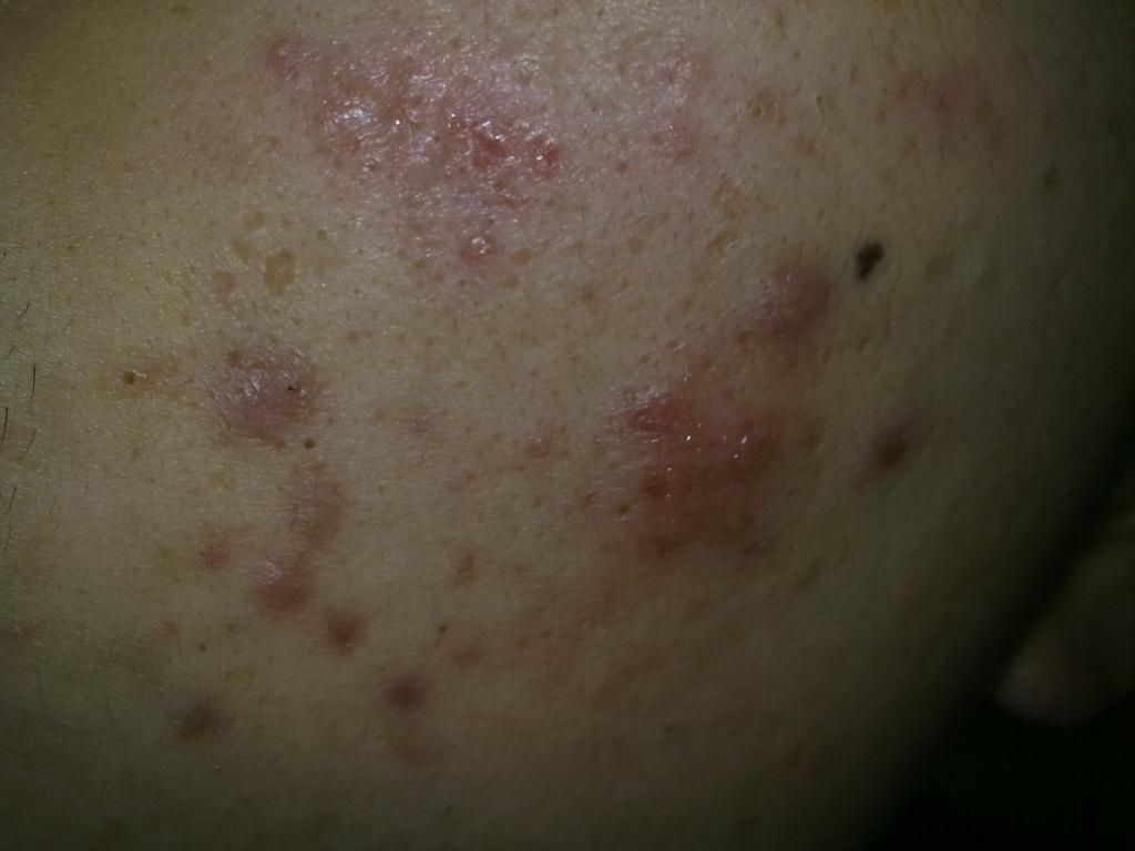 请你高诊?(图片超过100k,良版已修改,下次注意)