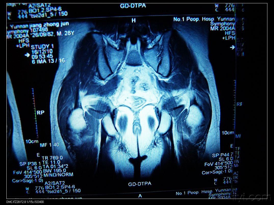 一张经过若干名医的眼睛的mr(请大家耐心看完发表意见,随后公布各京城