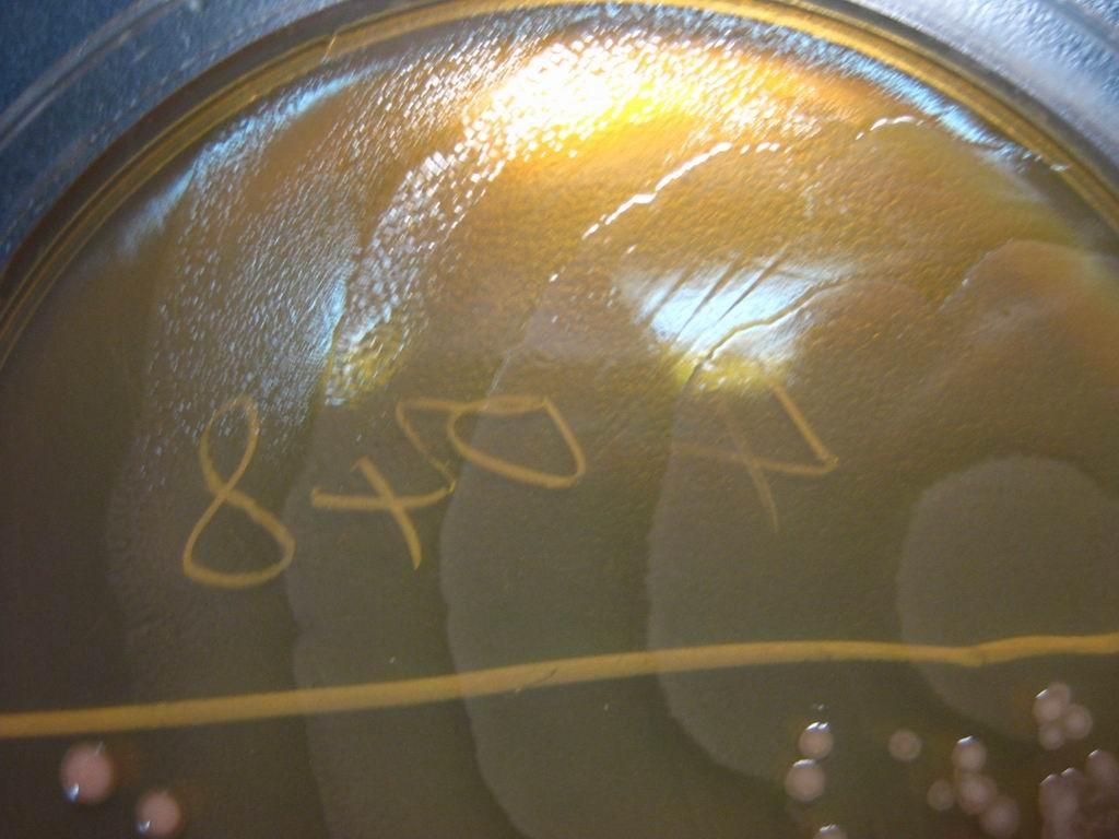 【原创图片】看图识菌——考考您的眼力2-变形杆菌