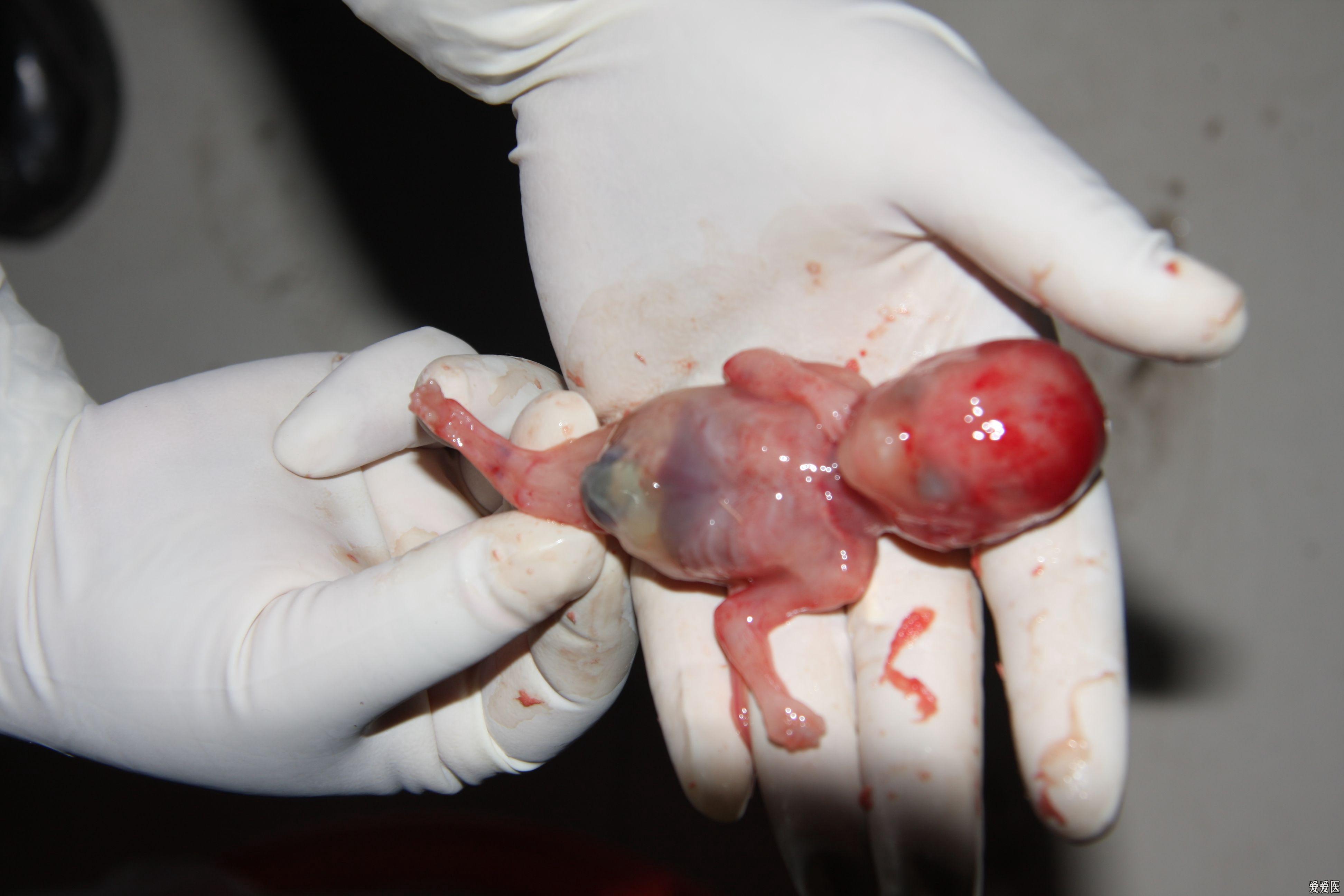 七个半月的胎儿图