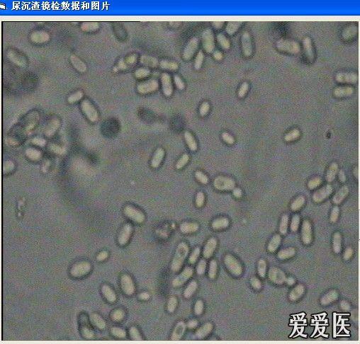 尿沉渣镜检图片