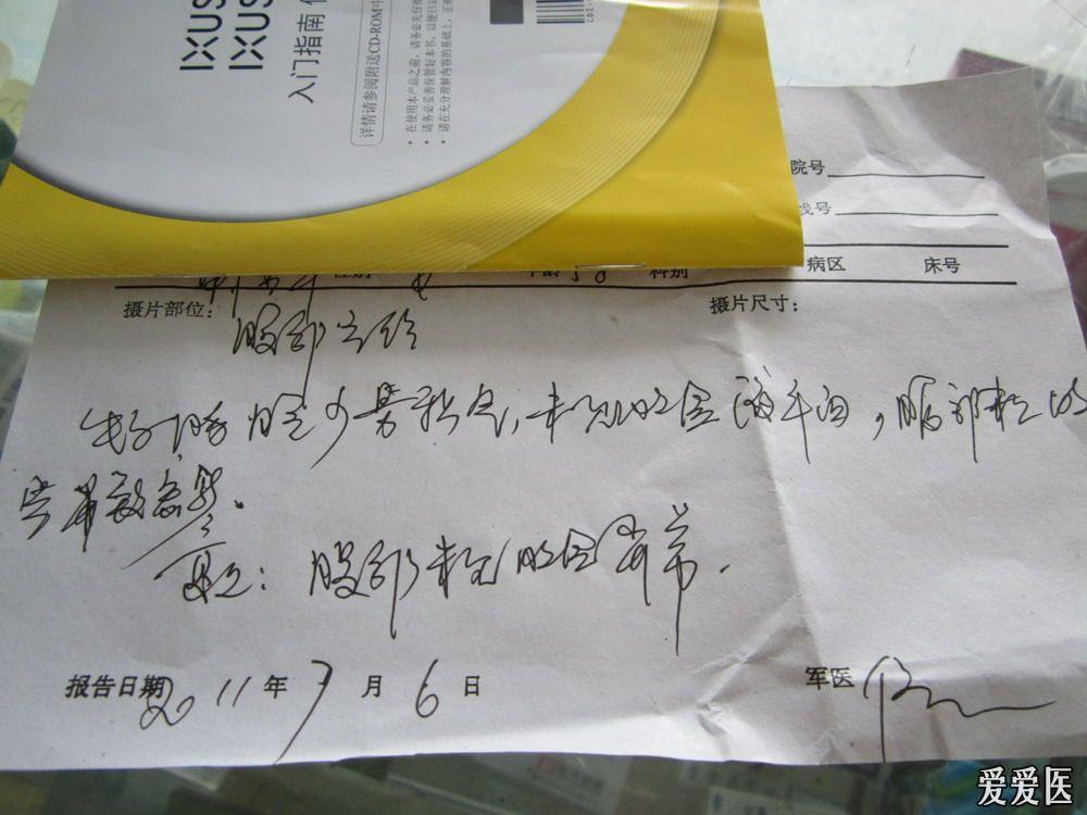 急性阑尾炎