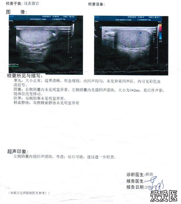 清晰地阴囊珠 请分析