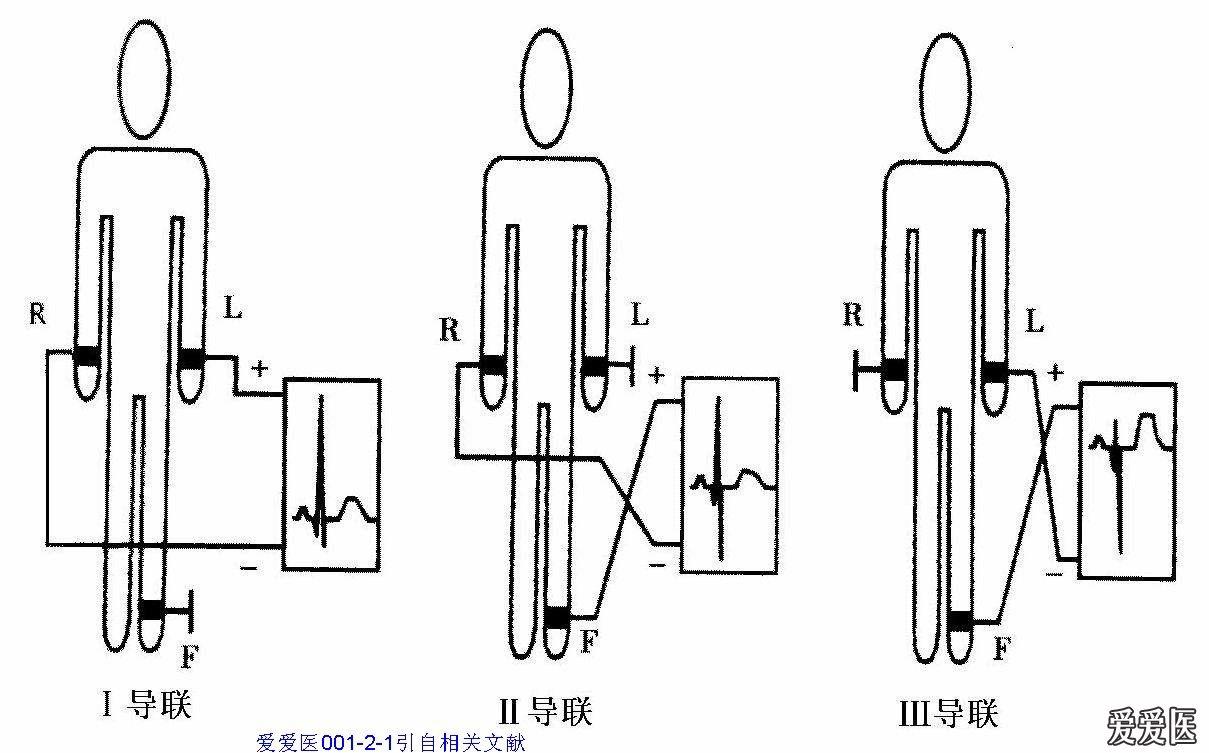 看图学心电01左右手反接与镜像右位心