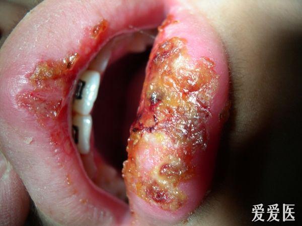 口腔医学专业讨论版 - 爱爱医医学论坛 - 爱爱医医学网