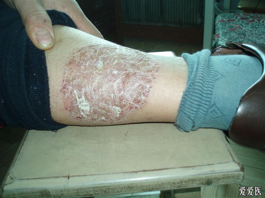 帮忙看看是什么病(镜下小虫一样的是什么东西)