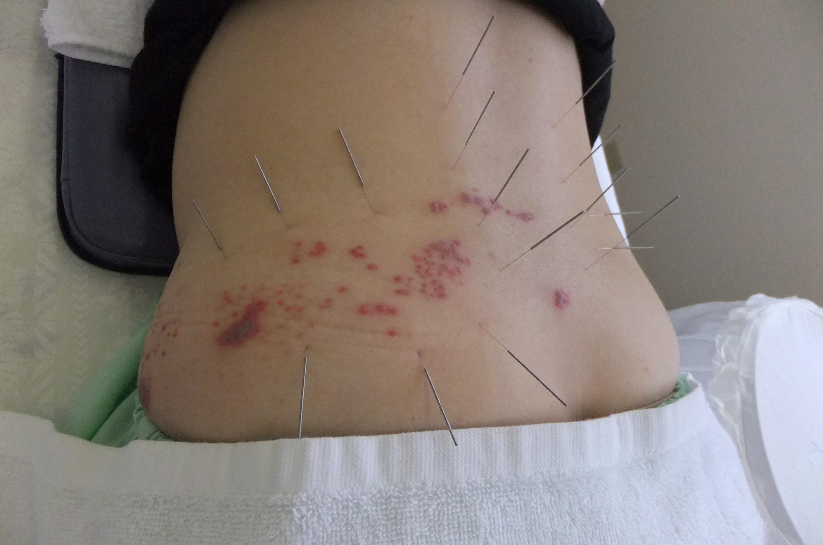 欢迎大家积极参与【爱爱医原创图片节】-全科医疗讨论版分站征稿