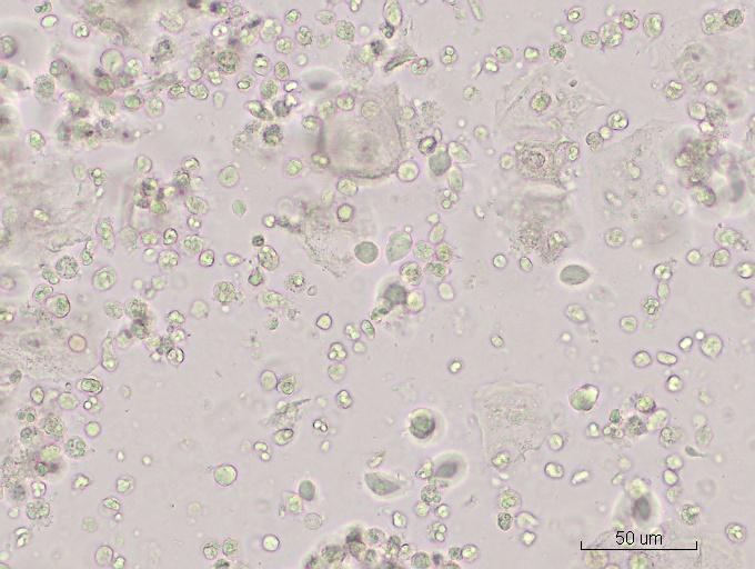 白带常规霉菌显微镜图片