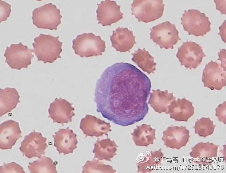 【有奖读图】#显微镜下的美丽#和王霄霞老师一起学习细胞形态学(第九