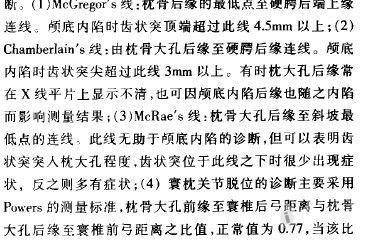 颅底凹陷,女,57岁