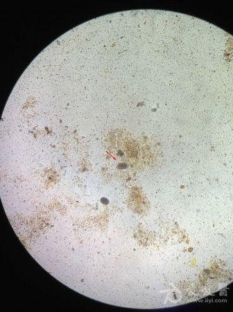 大便里霉菌镜鉴图片图片