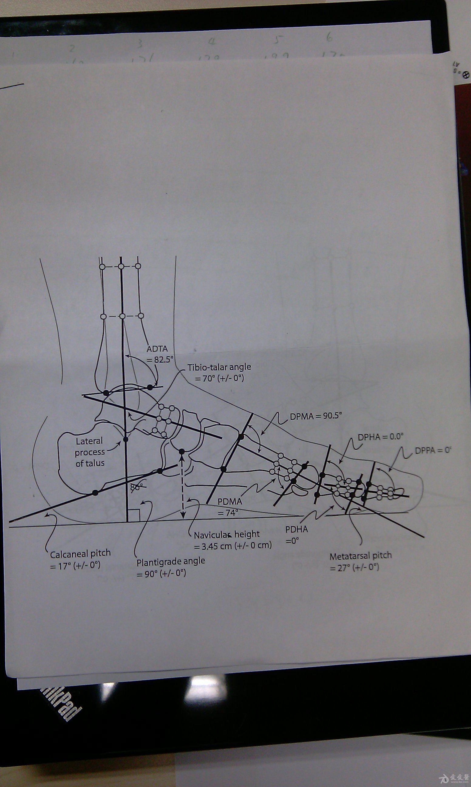 上传几张足踝解剖角度图,希望对研究足踝的朋友有所帮助.