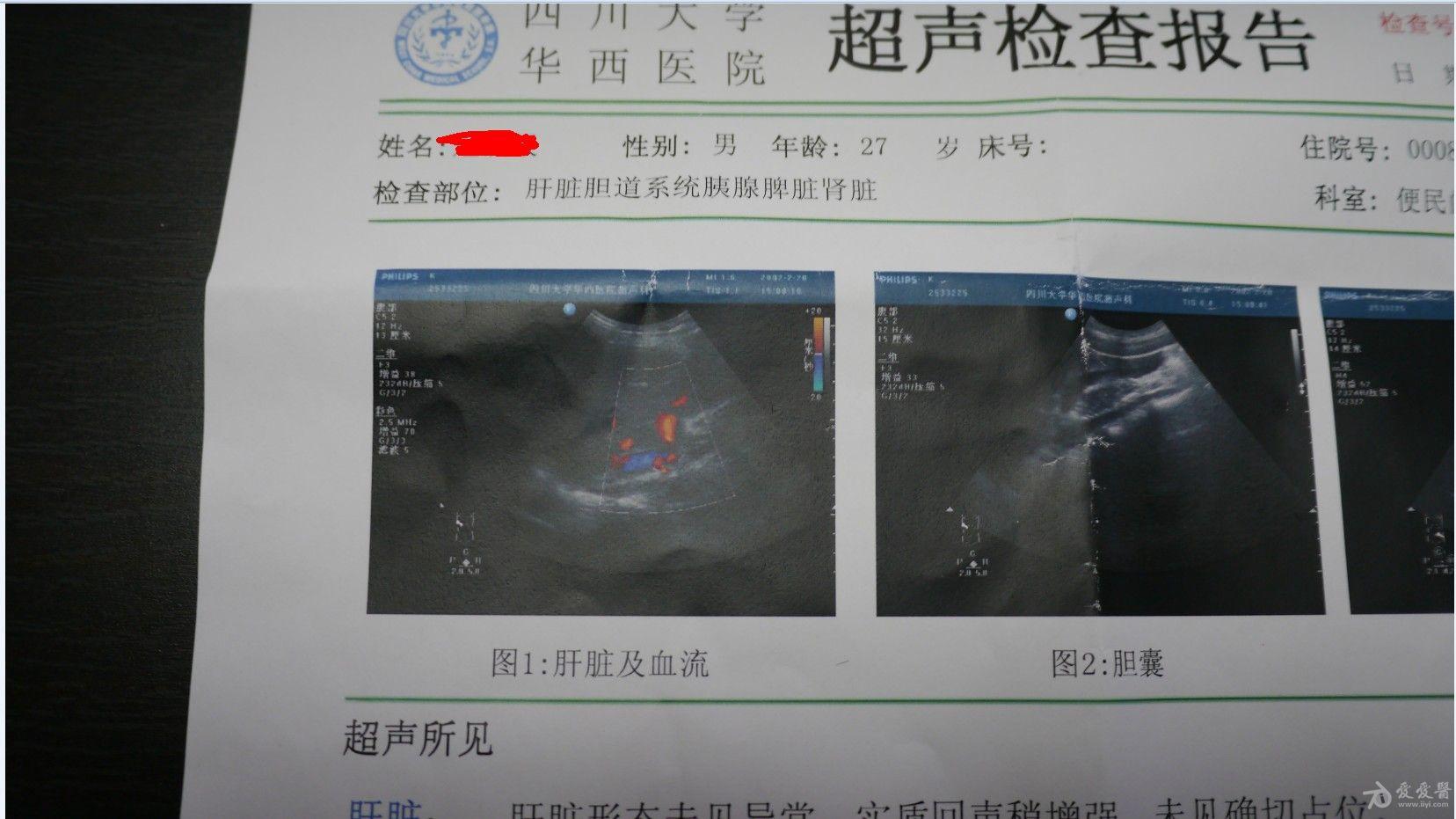 肝脏超声检查单判读