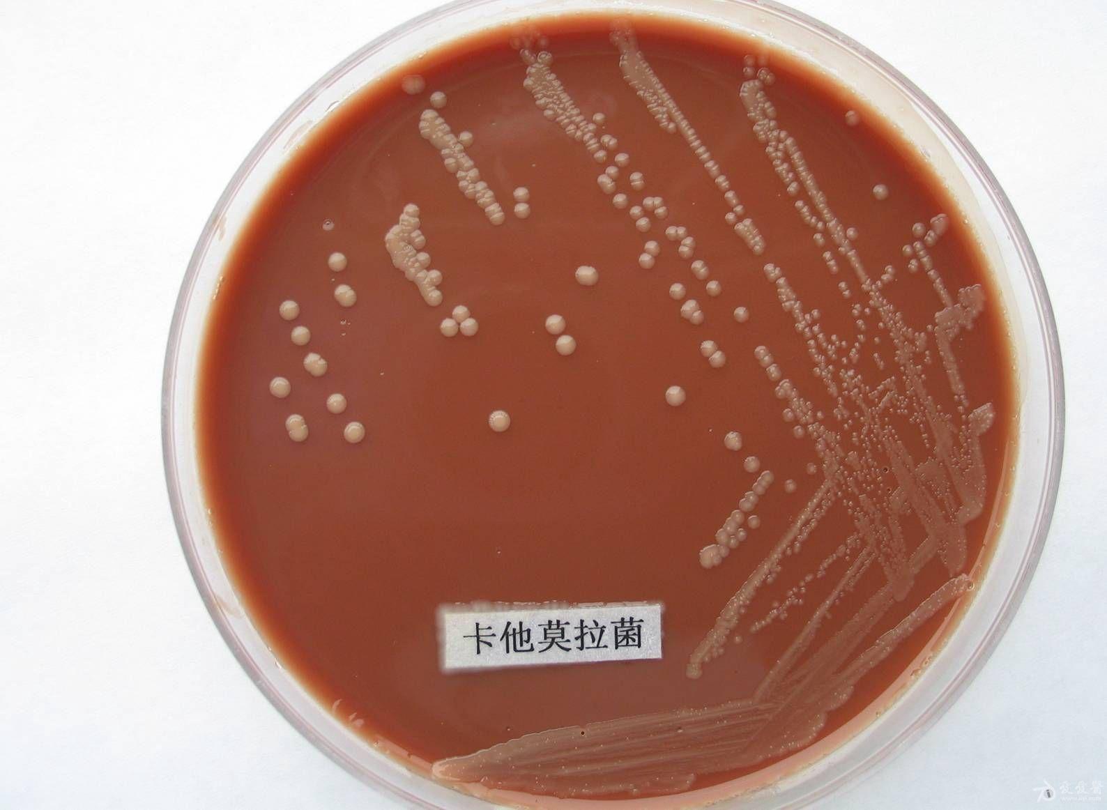 卡他莫拉菌感染图片