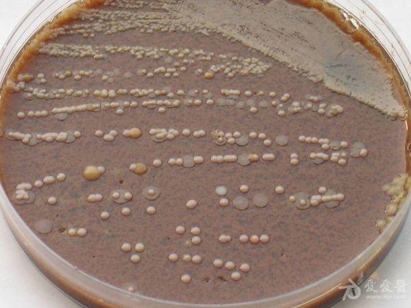 卡他莫拉菌的分离与鉴定