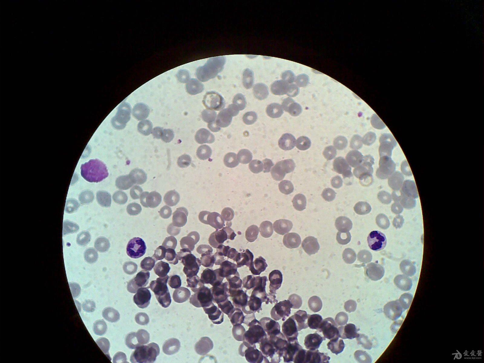 红细胞凝集素图片
