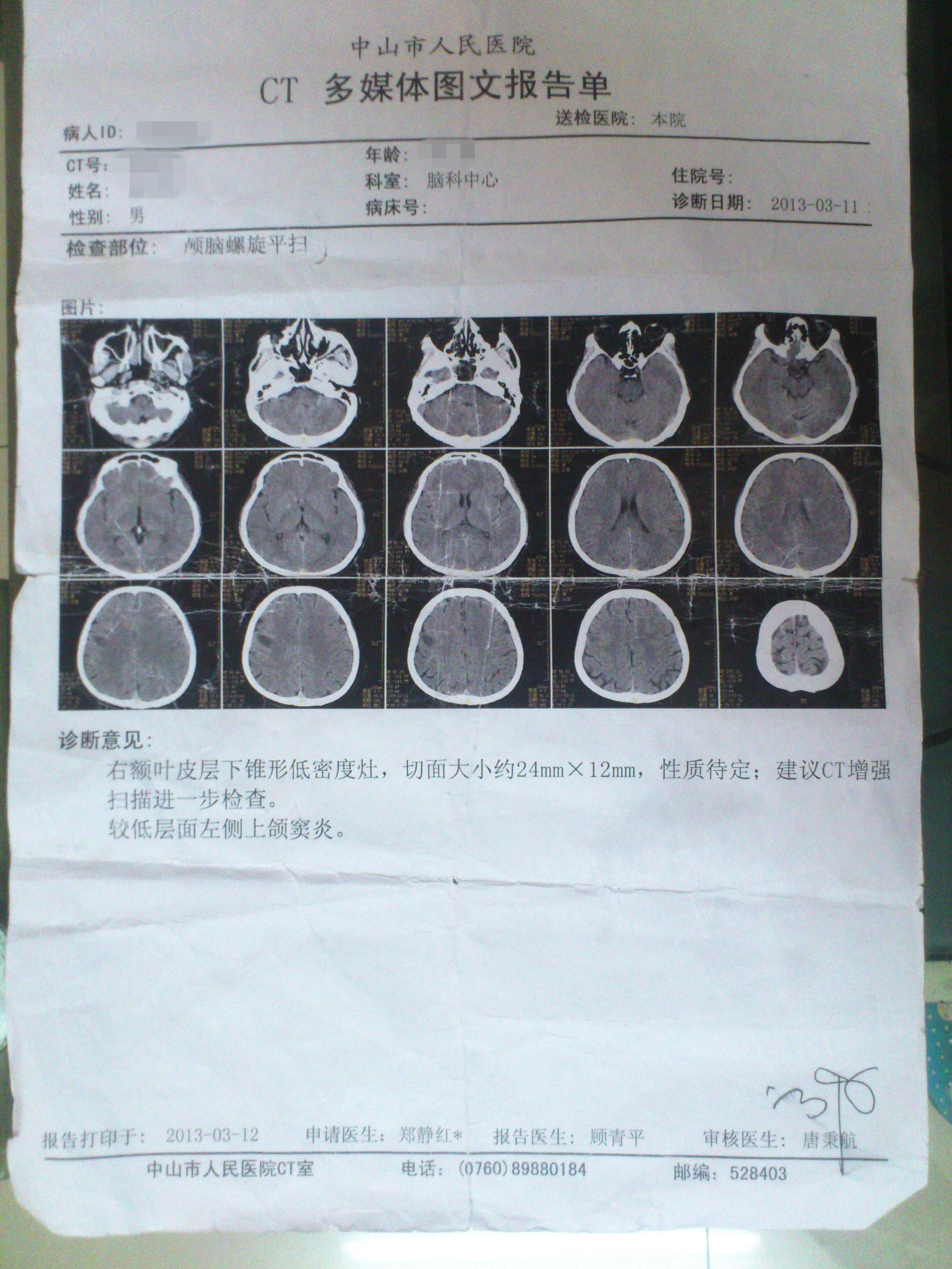 脑ct肿瘤报告图片图片